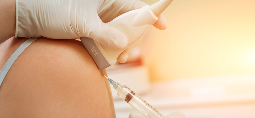 Hyaluronic Acid Injections