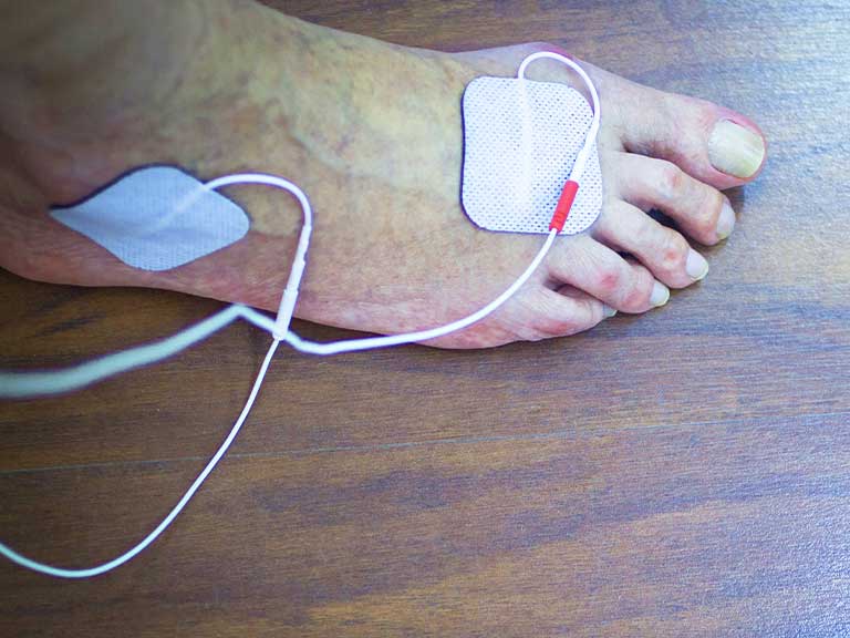 Patient recieving Microcurrent Therapy at Advanced Health & Wellness Center in Wadsworth for neuropathy relief